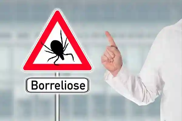 Achtung vor Borreliose